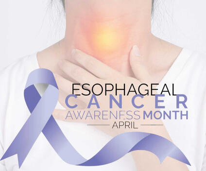 Esophealgal cancer post